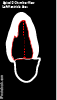 echo_apical2ch_LV_area.png