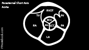 echo_psax_aorta.png