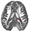 neuroBrainXsGrayBB716.gif