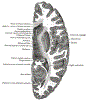 neuroBrainXsGrayBB742.gif