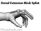 orthoFingerDorsalExtensionBlockSplint.jpg