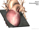 ultrasoundHeartApical.jpg