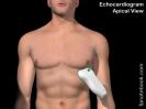 ultrasoundProbePositionEchoApical.jpg