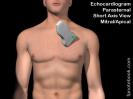 ultrasoundProbePositionEchoPSAX_apical.jpg
